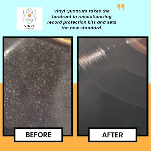 Vinyl Quantum - ערכת ניקוי רשומות ויניל - 5 -in -1 שלמה - כוללת מברשת רשומות קטיפה אולטרה -רכה, מברשת ניקוי קטנה, נוזל
