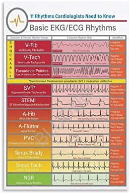 Bludug בסיסי EKG-ECG מקצבים פוסטר EKG מדריך לימוד פוסטר הערות סיעוד פוסטר פוסטרים פוסטרים והדפסים תמונות אמנות