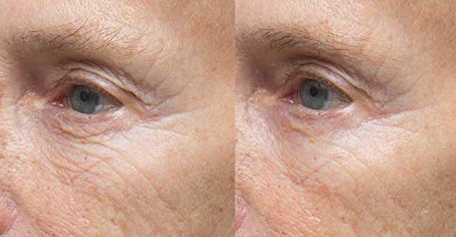 דר דנס דלינק מדע הידרושילד סרום הידרציה אינטנסיבית לעור סביב עיניים עשירות בסרמידות, ליפידים ביו-זהים, רטינול,