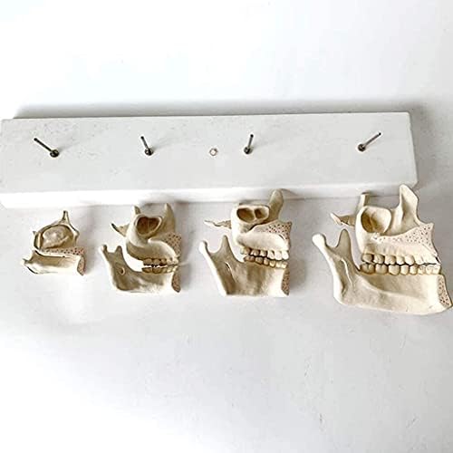 שיניים הוראת צמיחת השוואה סדרת חניכיים פה סיעוד האנטומיה דגם רפואי דגם